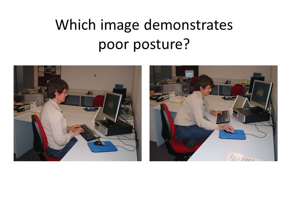 Which image demonstrates poor posture