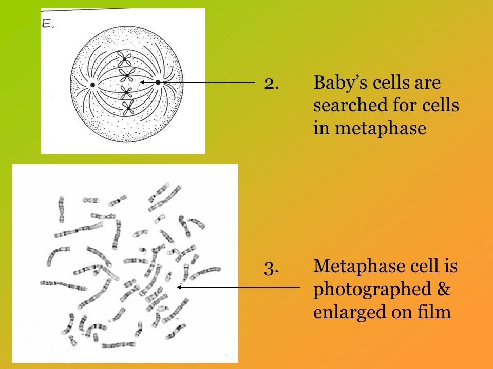 2.Baby’s cells are searched for cells in metaphase 3.Metaphase cell is photographed & enlarged on film