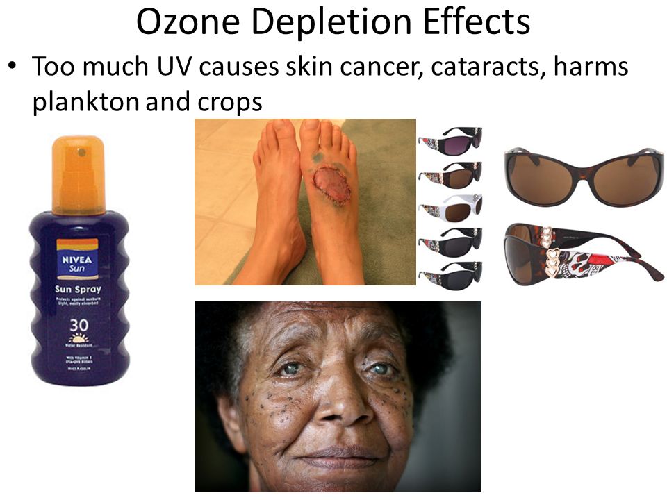 Ozone Depletion Effects Too much UV causes skin cancer, cataracts, harms plankton and crops