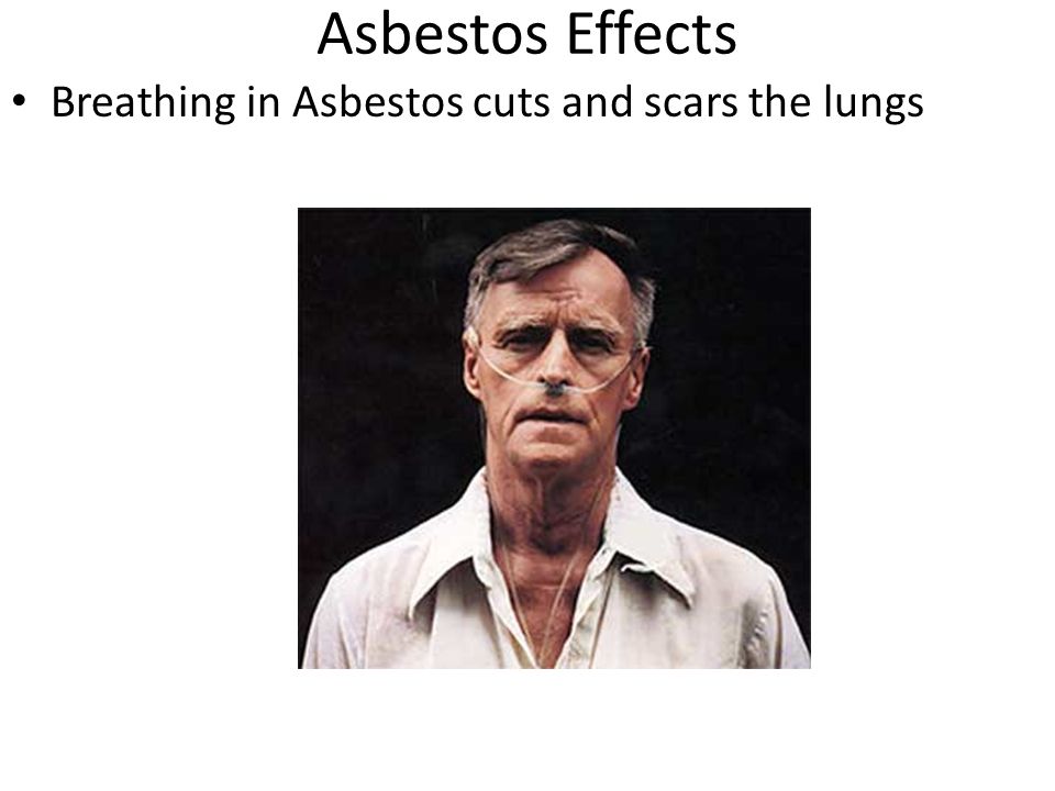 Asbestos Effects Breathing in Asbestos cuts and scars the lungs