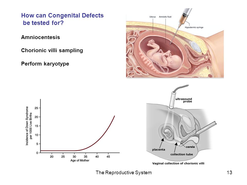 The Reproductive System13 How can Congenital Defects be tested for.