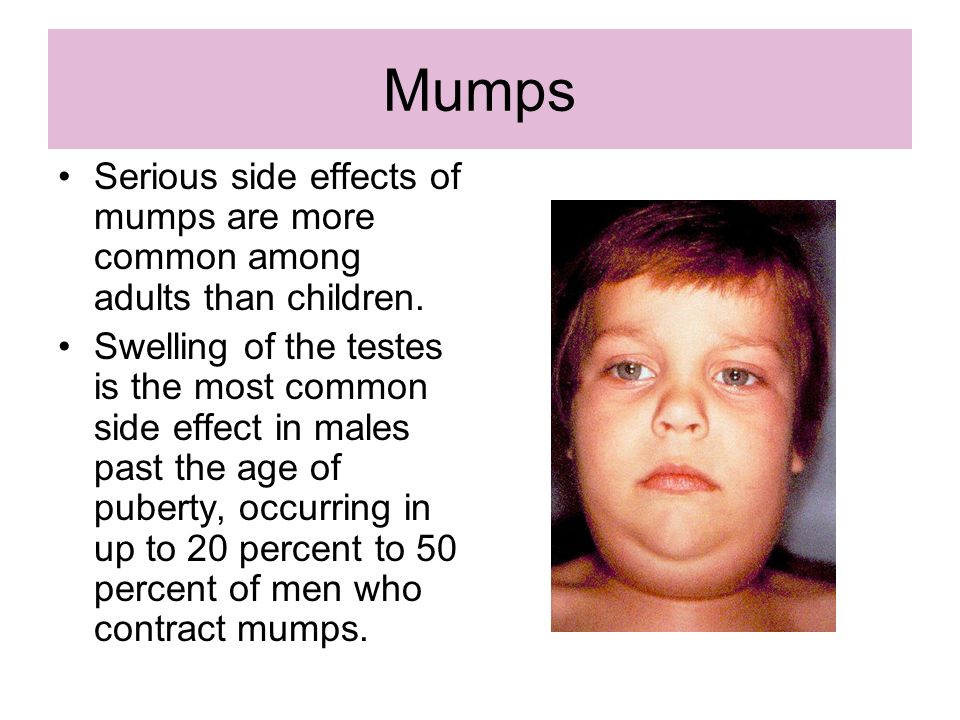 prednisone side-effects with pictures prednisone side-effects with pictures