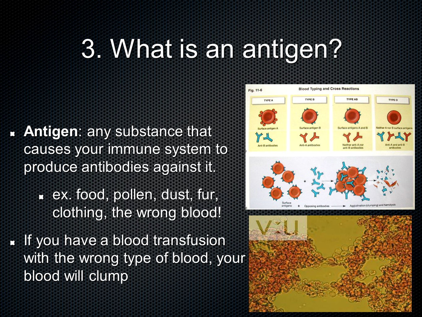 3. What is an antigen.