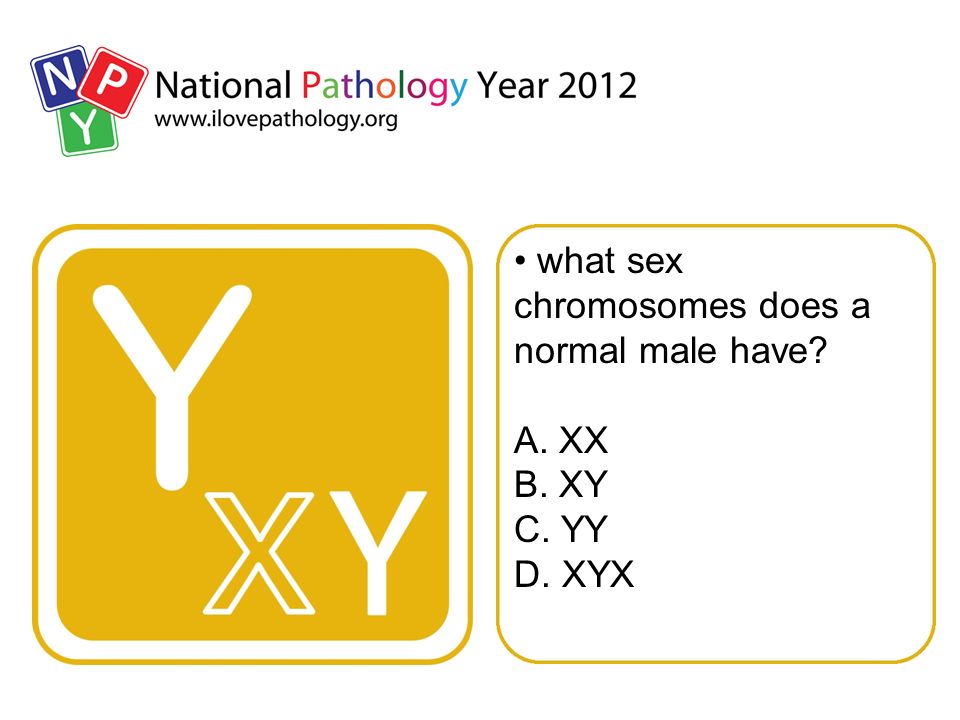 what sex chromosomes does a normal male have A. XX B. XY C. YY D. XYX