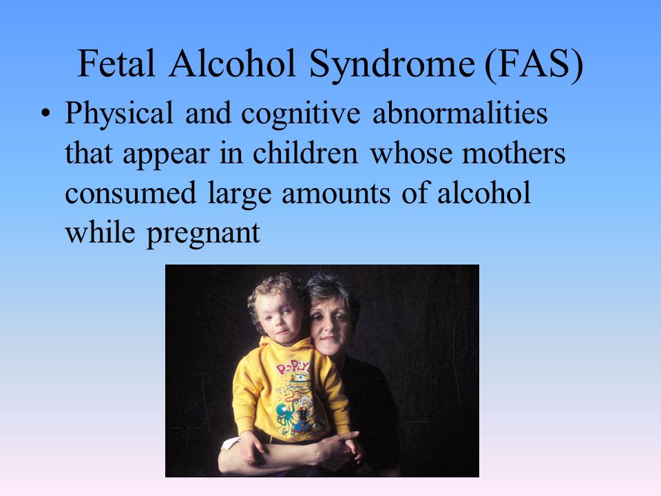 Fetal Alcohol Syndrome (FAS) Physical and cognitive abnormalities that appear in children whose mothers consumed large amounts of alcohol while pregnant