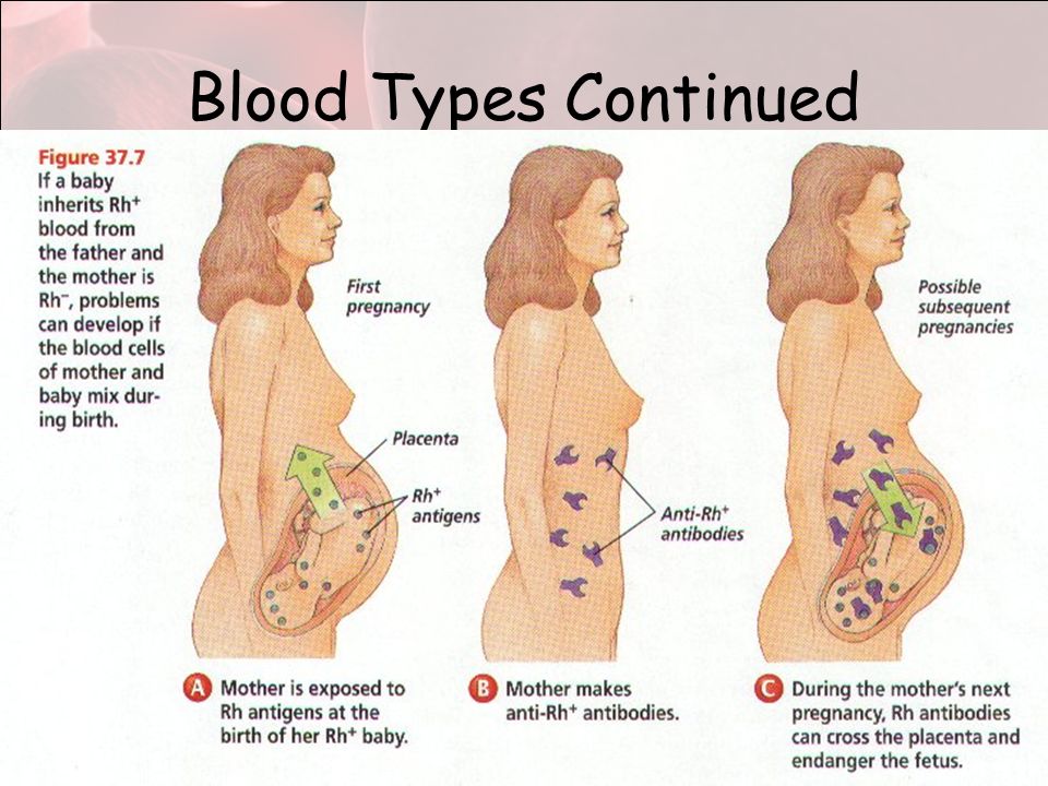 Blood Types Continued Anti-Rh antibodies –No blood usually contains this antibody –Can show up in blood of an Rh-negative type comes into contact with an Rh-positive type Transfusions Pregnant women with Rh-negative blood –Fetus is Rh-positive (gene from dad) –Blood mixes at birth – mother’s body makes anti-Rh antibodies (no harm to mother) –During the 2 nd pregnancy the antibodies could attack the fetus and destroy = erythroblastosis fetalis
