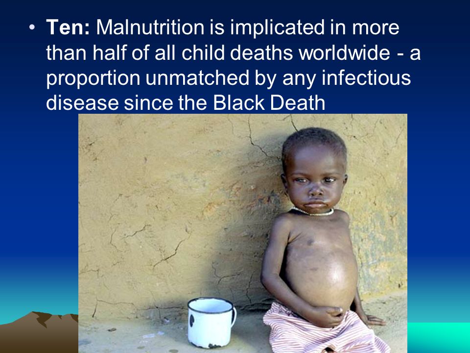 Ten: Malnutrition is implicated in more than half of all child deaths worldwide - a proportion unmatched by any infectious disease since the Black Death