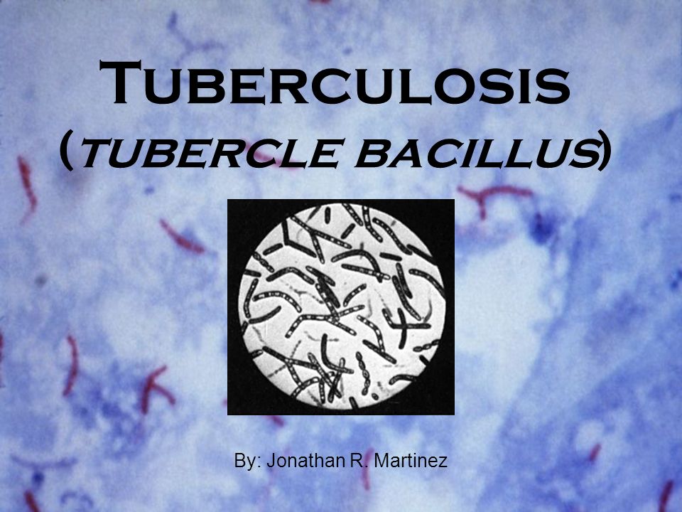 Literature Review On Tuberculosis