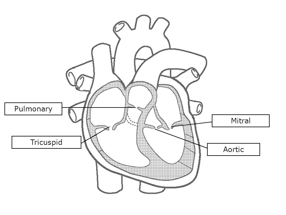 Aortic Tricuspid Pulmonary Mitral