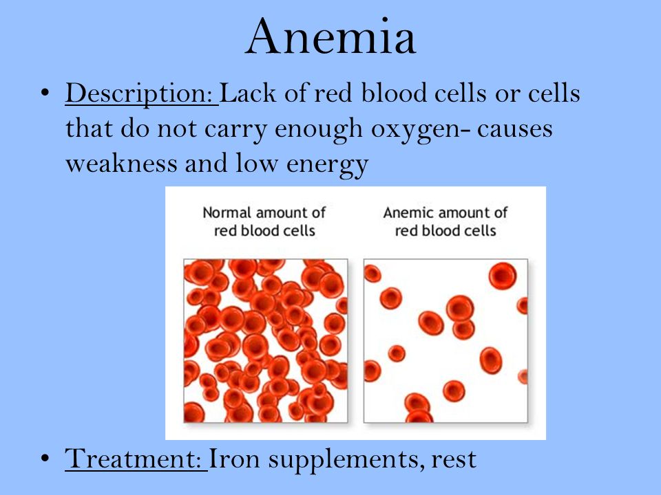 Anemia Description: Lack of red blood cells or cells that do not carry enough oxygen- causes weakness and low energy Treatment: Iron supplements, rest