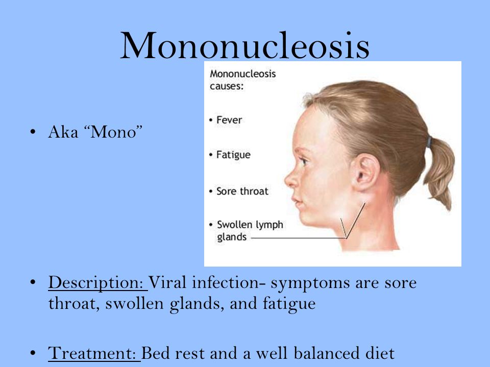 Mononucleosis Aka Mono Description: Viral infection- symptoms are sore throat, swollen glands, and fatigue Treatment: Bed rest and a well balanced diet