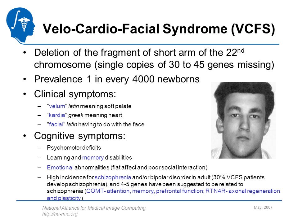 Sperm and whales and mediterranean sea and primary and document Velo cardio facial syndrom