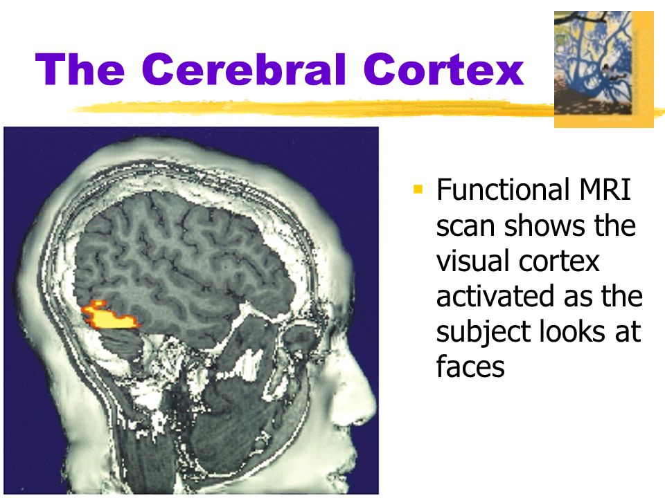  Functional MRI scan shows the visual cortex activated as the subject looks at faces
