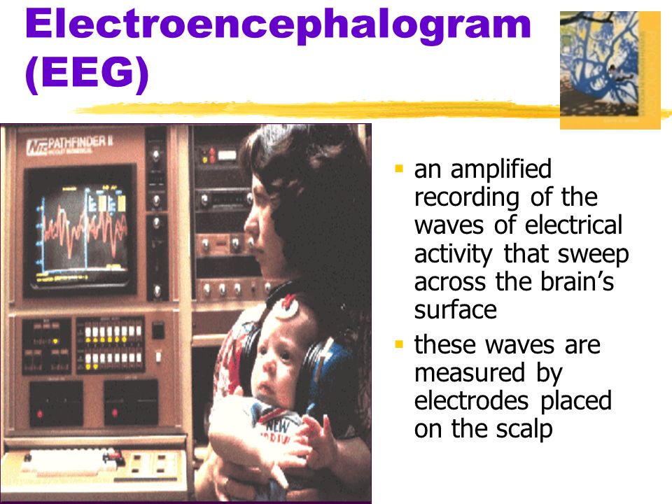 Electroencephalogram (EEG)  an amplified recording of the waves of electrical activity that sweep across the brain’s surface  these waves are measured by electrodes placed on the scalp