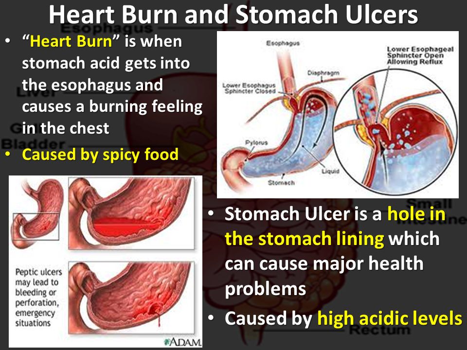 Esophagus and burning feeling