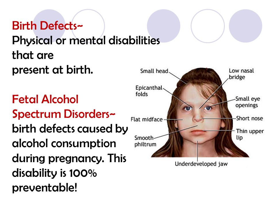 psychological effects of foetal birth defects Fetal retinoid syndrome is a characteristic pattern of physical and mental birth defects that results from maternal use of retinoids during pregnancy the most well known retinoid is isotretinoin (accutane), a drug used to treat severe cystic acne. psychological effects of foetal birth defects Fetal retinoid syndrome is a characteristic pattern of physical and mental birth defects that results from maternal use of retinoids during pregnancy the most well known retinoid is isotretinoin (accutane), a drug used to treat severe cystic acne.