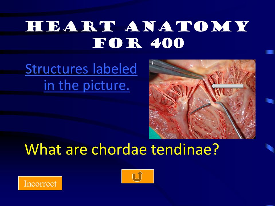 Heart Anatomy for 300 Incorrect What is the right atrium