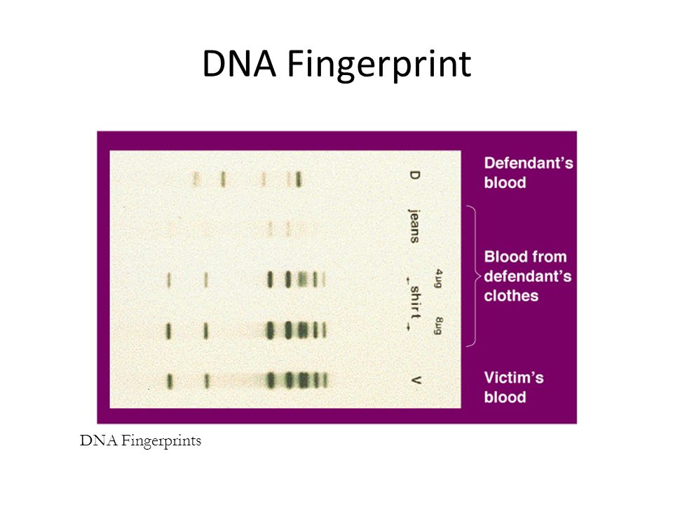 DNA Fingerprint DNA Fingerprints