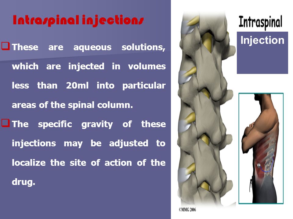 Intraspinal drug administration