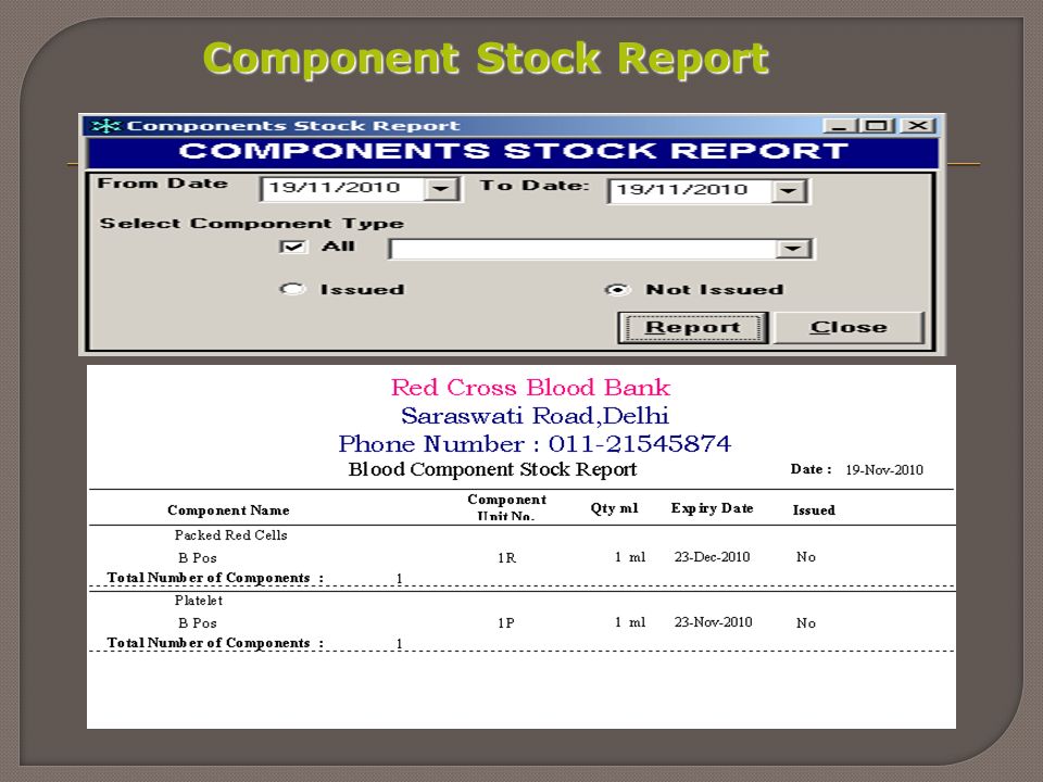 Component Stock Report