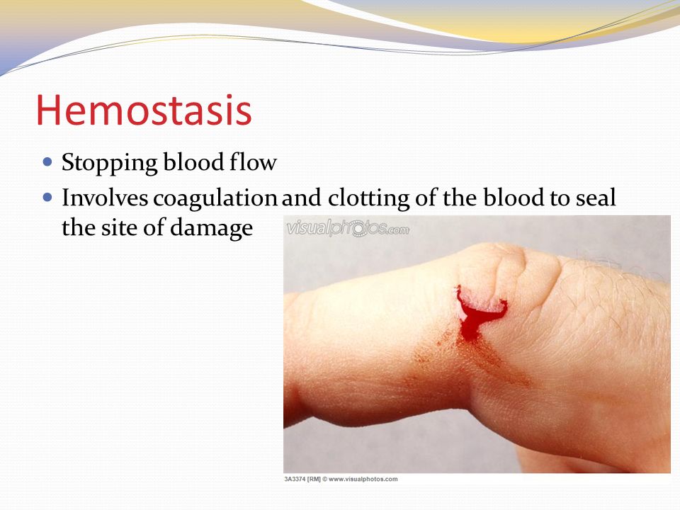 Hemostasis Stopping blood flow Involves coagulation and clotting of the blood to seal the site of damage