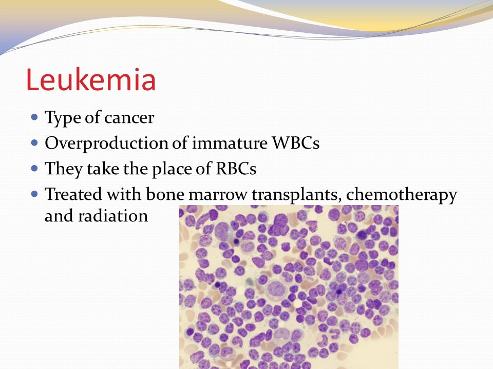 Leukemia Type of cancer Overproduction of immature WBCs They take the place of RBCs Treated with bone marrow transplants, chemotherapy and radiation