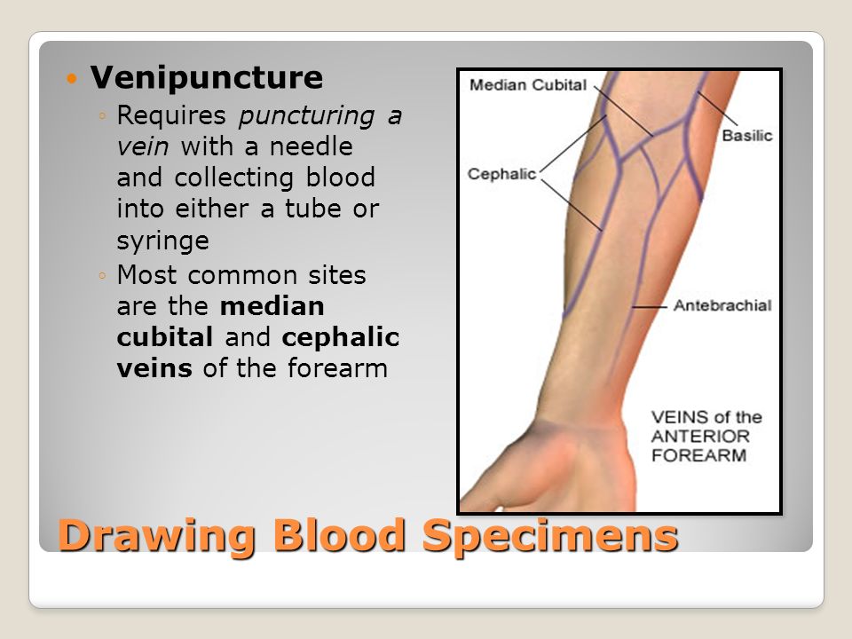 venipuncture blood and vein Instruction for blood specimen collection for geisinger medical laboratories blood specimen collection and processing the venipuncture procedure is complex. venipuncture blood and vein Instruction for blood specimen collection for geisinger medical laboratories blood specimen collection and processing the venipuncture procedure is complex.