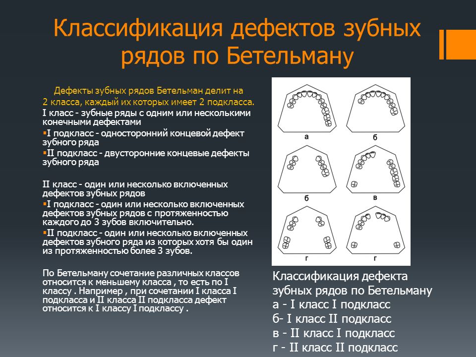 Детские дефекты зубов Детские дефекты зубов