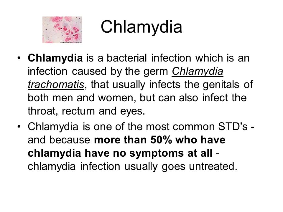 the symptoms and treatment of chlamydia infection the most common std in the united states the symptoms and treatment of chlamydia infection the most common std in the united states