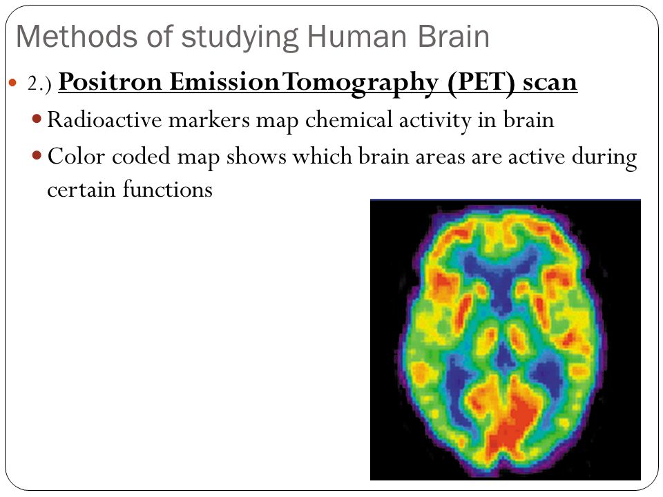Methods of studying Human Brain 2.) Positron Emission Tomography (PET) scan Radioactive markers map chemical activity in brain Color coded map shows which brain areas are active during certain functions