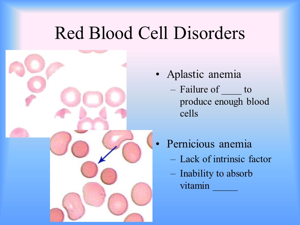 Red Blood Cell Disorders Aplastic anemia –Failure of ____ to produce enough blood cells Pernicious anemia –Lack of intrinsic factor –Inability to absorb vitamin _____