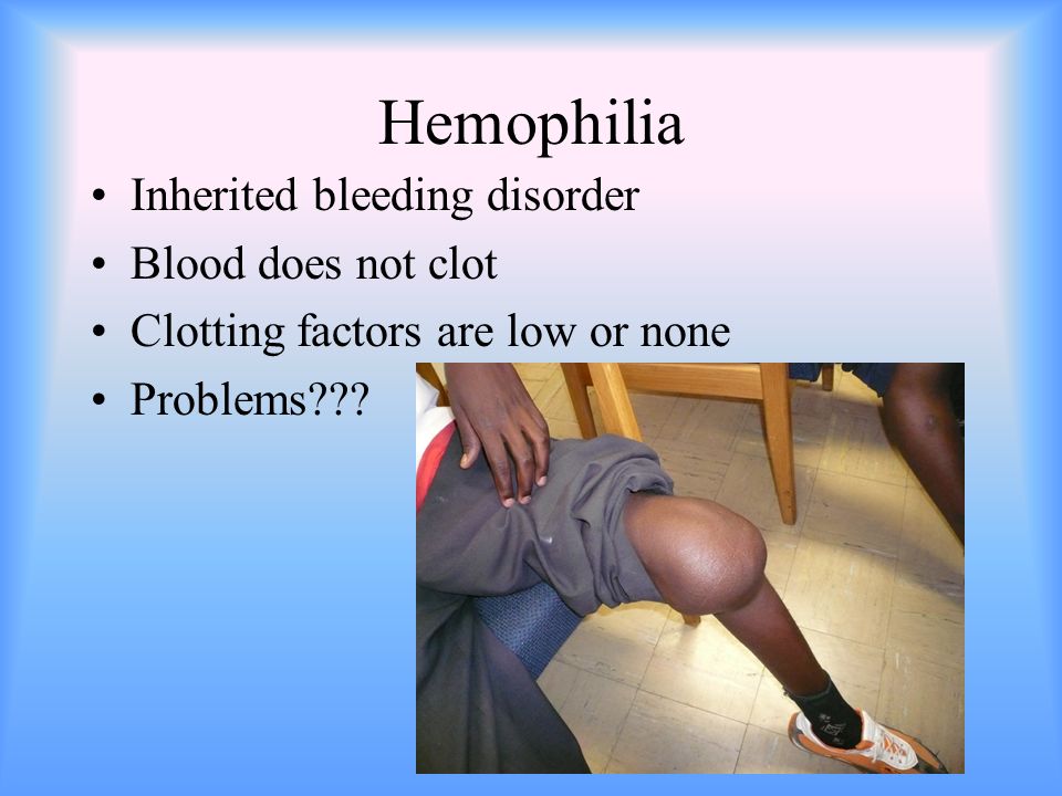 Hemophilia Inherited bleeding disorder Blood does not clot Clotting factors are low or none Problems