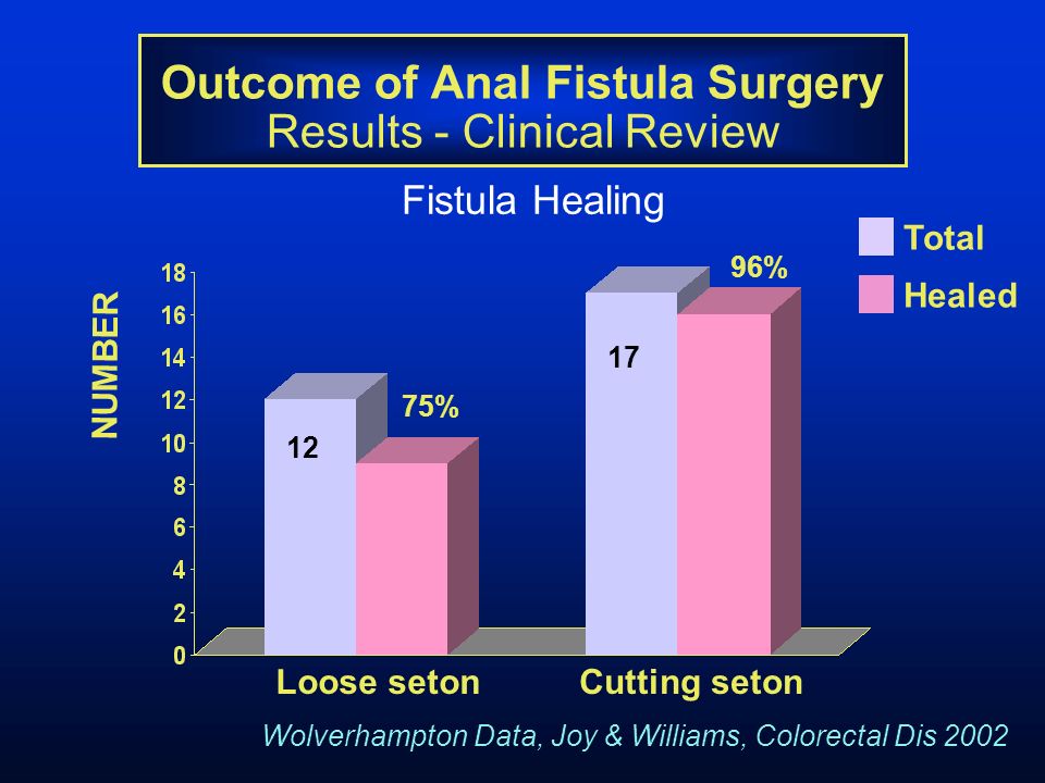 Seton marker for anal fistual Teen porn warning blond teen
