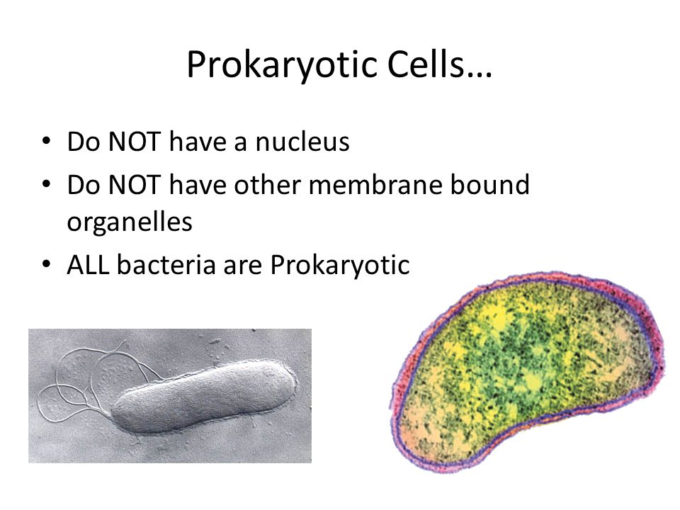 Prokaryotic Cells… Do NOT have a nucleus Do NOT have other membrane bound organelles ALL bacteria are Prokaryotic