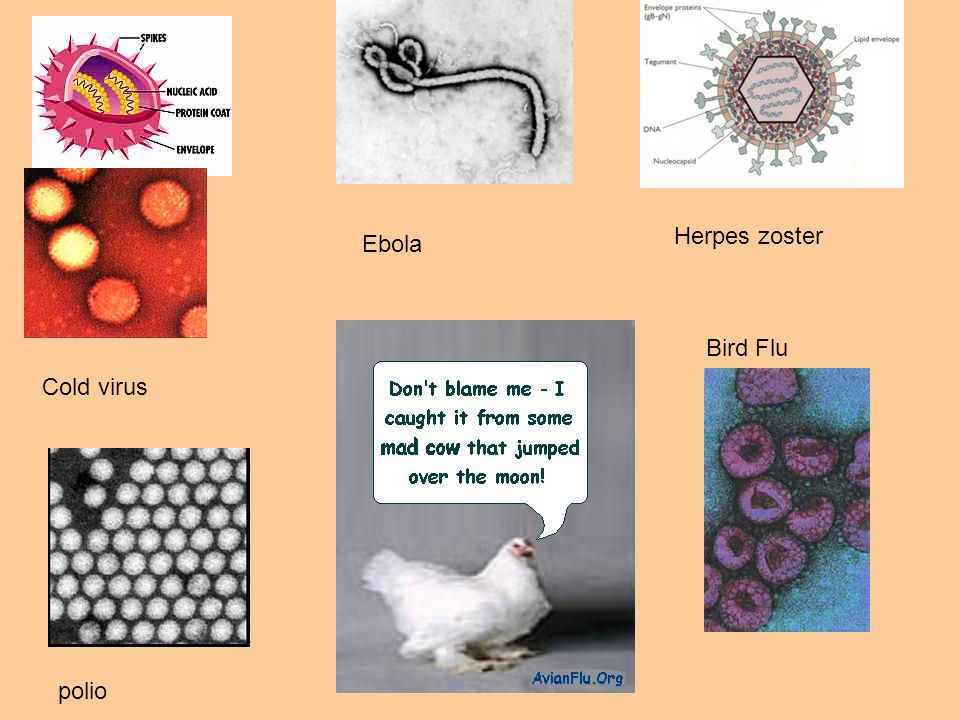 viral diseases cold flu polio measles herpes virus