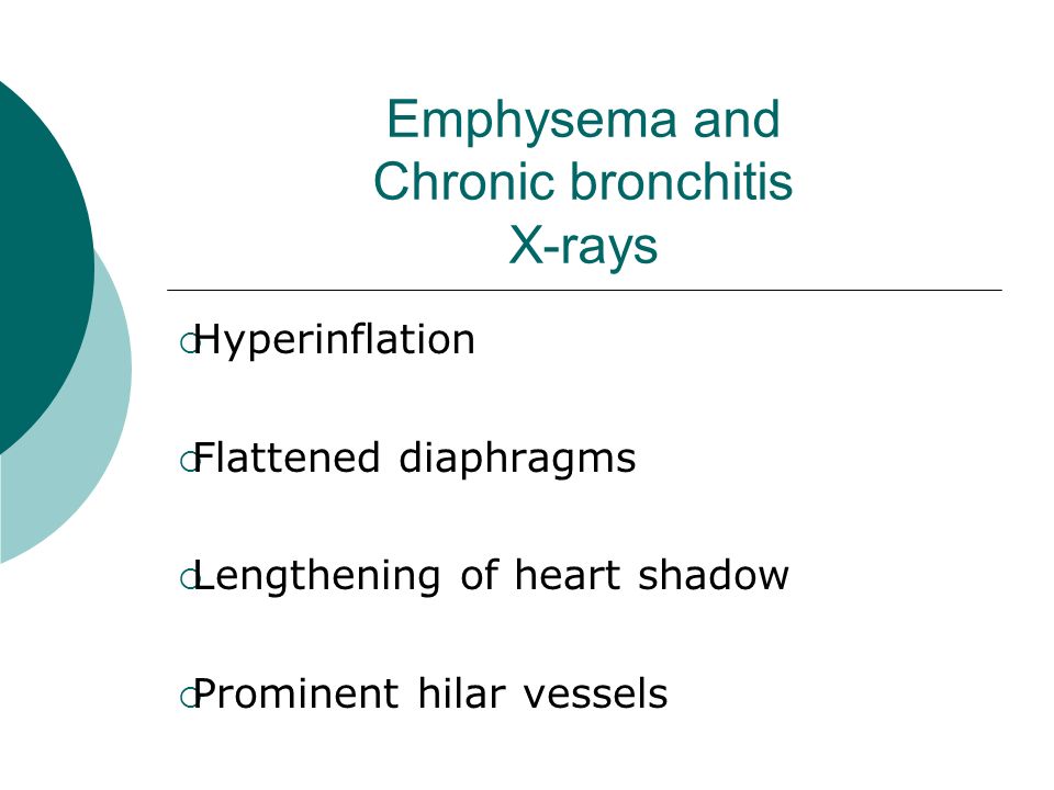 chronic bronchitis and emphysema I what every physician needs to know chronic obstructive pulmonary disease (copd), characterized by emphysema or chronic bronchitis, is a progressive, inflammatory disease that results in airflow limitation with some combination of small airway obstruction and lung destruction copd is the fourth. chronic bronchitis and emphysema I what every physician needs to know chronic obstructive pulmonary disease (copd), characterized by emphysema or chronic bronchitis, is a progressive, inflammatory disease that results in airflow limitation with some combination of small airway obstruction and lung destruction copd is the fourth.