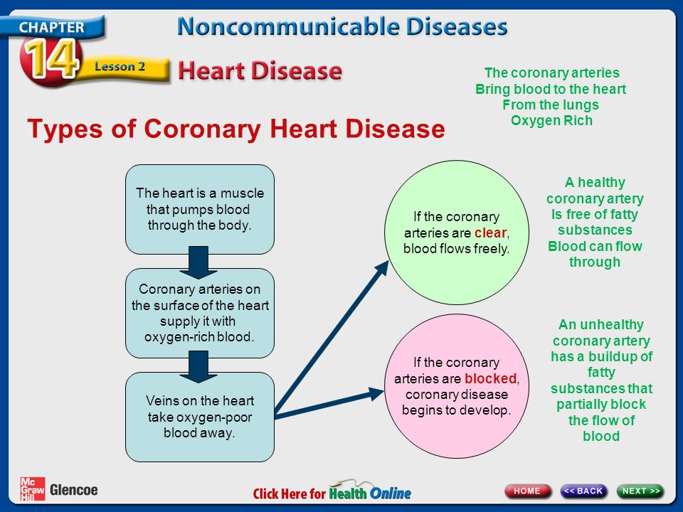 Types of Coronary Heart Disease The heart is a muscle that pumps blood through the body.