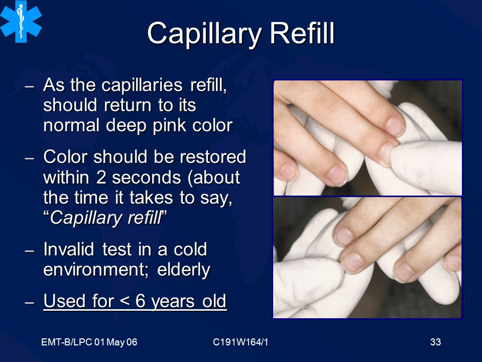 What is the capillary refill test?