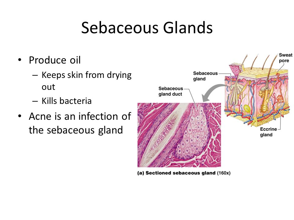Sebaceous Glands Produce oil – Keeps skin from drying out – Kills bacteria Acne is an infection of the sebaceous gland