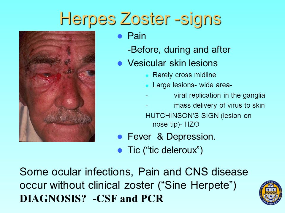 herpes zoster Shingles (herpes zoster) is an outbreak of rash or blisters on the skin that is caused by the same virus that causes chickenpox — the varicella-zoster virus. herpes zoster Shingles (herpes zoster) is an outbreak of rash or blisters on the skin that is caused by the same virus that causes chickenpox — the varicella-zoster virus.