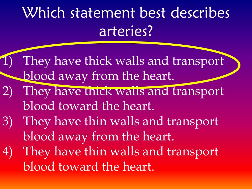 Which statement best describes arteries.
