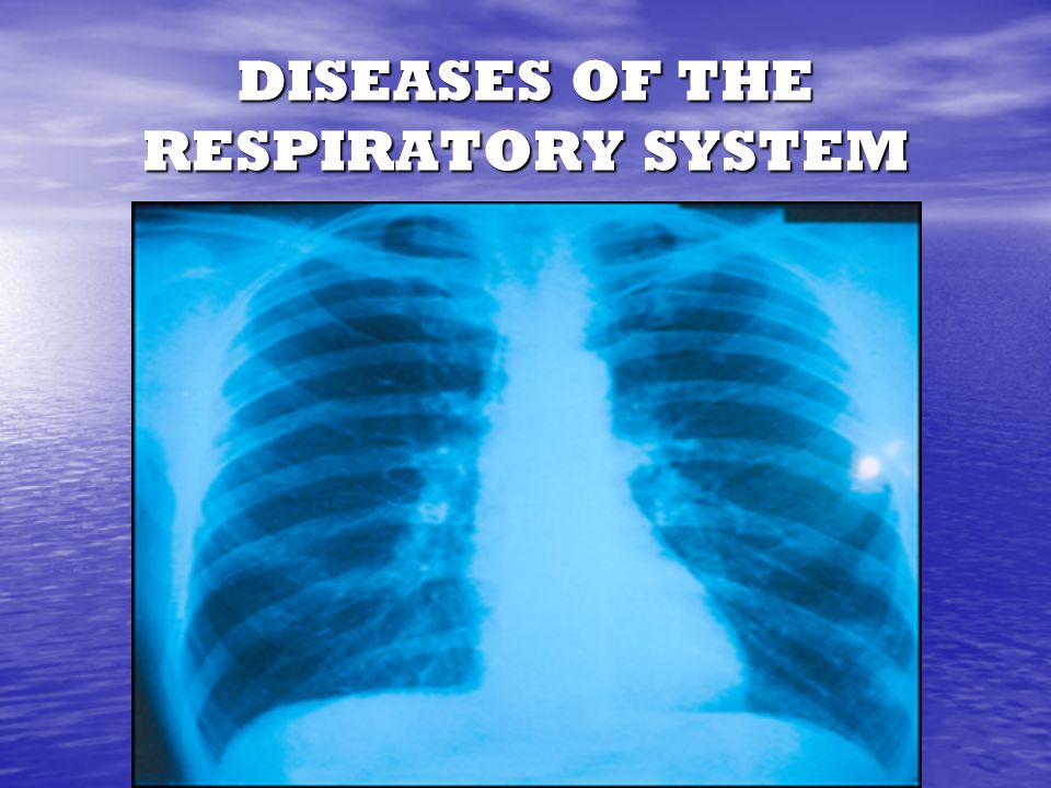 DISEASES OF THE RESPIRATORY SYSTEM