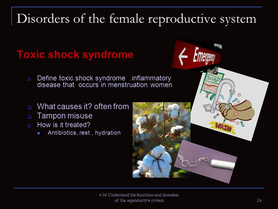 a definition of the illness of toxic shock syndrome Toxic shock syndrome (tss) is an uncommon, but potentially serious, illness that occurs when poisonous substances (toxins) produced by certain bacteria enter the bloodstream. a definition of the illness of toxic shock syndrome Toxic shock syndrome (tss) is an uncommon, but potentially serious, illness that occurs when poisonous substances (toxins) produced by certain bacteria enter the bloodstream.
