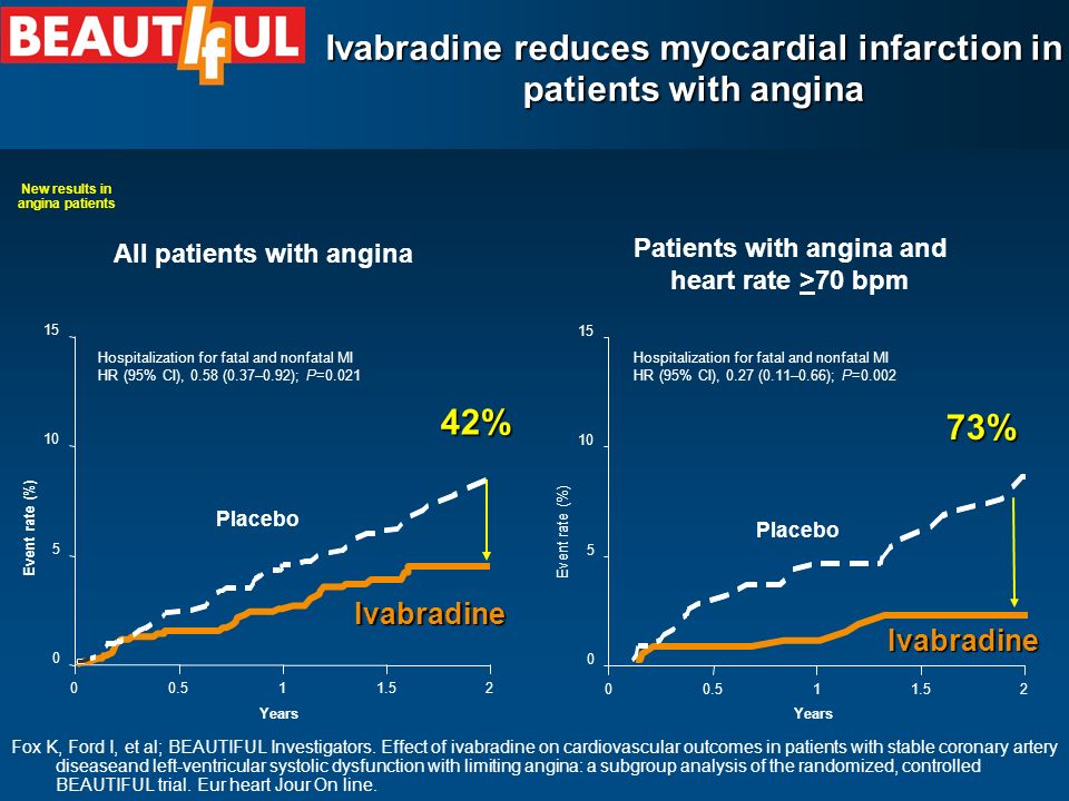 Ivabradine reduces myocardial infarction in patients with angina All patients with angina Patients with angina and heart rate >70 bpm Placebo Ivabradine Hospitalization for fatal and nonfatal MI HR (95% CI), 0.58 (0.37–0.92); P=0.021 Years Event rate (%) 42% Placebo Ivabradine Hospitalization for fatal and nonfatal MI HR (95% CI), 0.27 (0.11–0.66); P=0.002 Years Event rate (%) 73% Fox K, Ford I, et al; BEAUTIFUL Investigators.