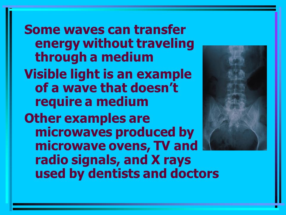 Some waves can transfer energy without traveling through a medium Visible light is an example of a wave that doesn’t require a medium Other examples are microwaves produced by microwave ovens, TV and radio signals, and X rays used by dentists and doctors