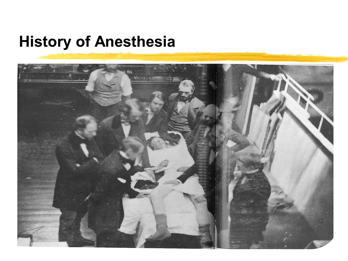 history of anesthesia essay A brief history of anesthesia care in america, as highlighted in this study, has clearly shown that nurse as well as physician anesthetists have cooperated right from the start even though the political turmoil amid asa (anesthesiologists) and aana (crnas) will probably continue, the majority of anesthesia care is securely and. history of anesthesia essay A brief history of anesthesia care in america, as highlighted in this study, has clearly shown that nurse as well as physician anesthetists have cooperated right from the start even though the political turmoil amid asa (anesthesiologists) and aana (crnas) will probably continue, the majority of anesthesia care is securely and.