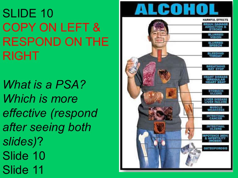 SLIDE 10 COPY ON LEFT & RESPOND ON THE RIGHT What is a PSA.