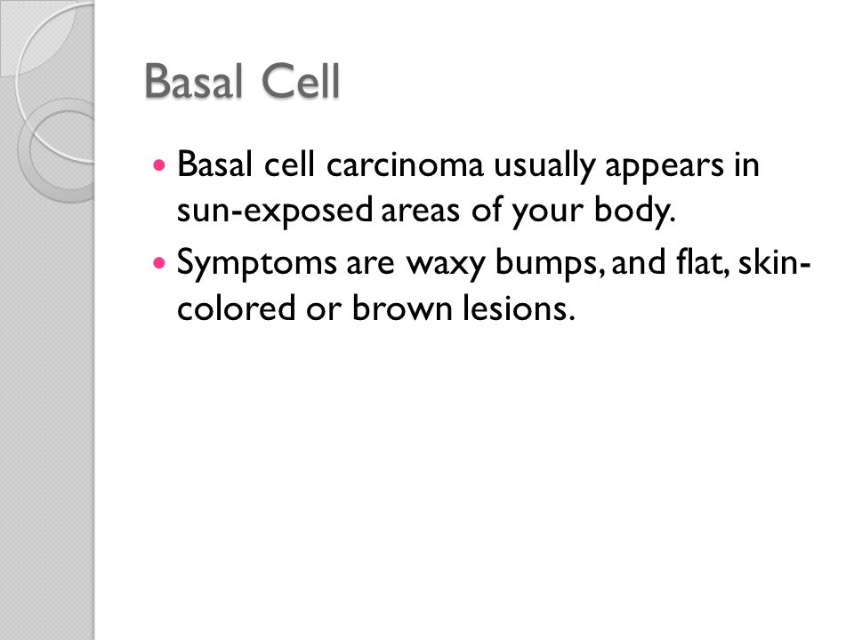 Basal Cell Basal cell carcinoma usually appears in sun-exposed areas of your body.