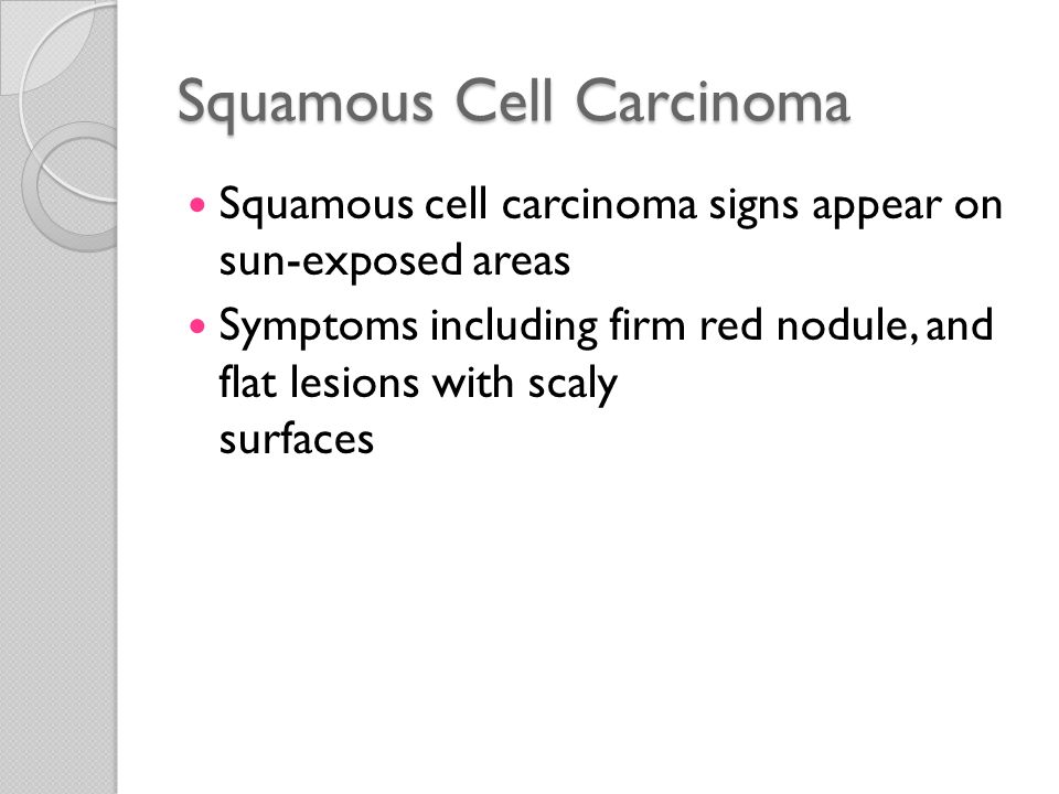 Squamous Cell Carcinoma Squamous cell carcinoma signs appear on sun-exposed areas Symptoms including firm red nodule, and flat lesions with scaly surfaces