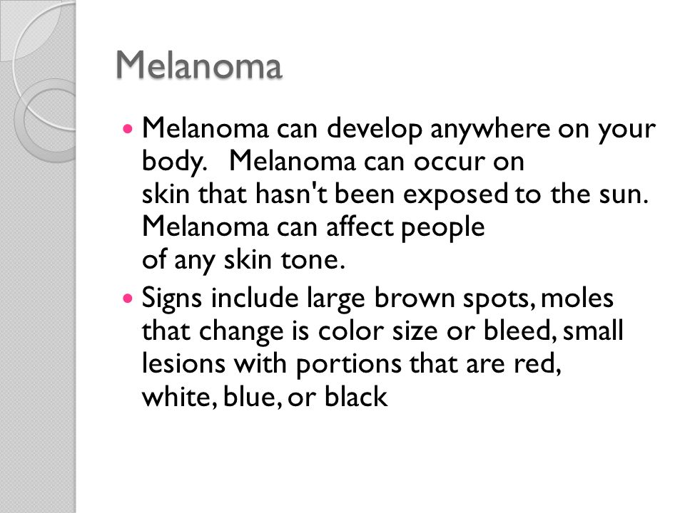 Melanoma Melanoma can develop anywhere on your body.